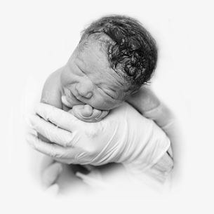 A method for determining birth asphyxia at the moment of delivery